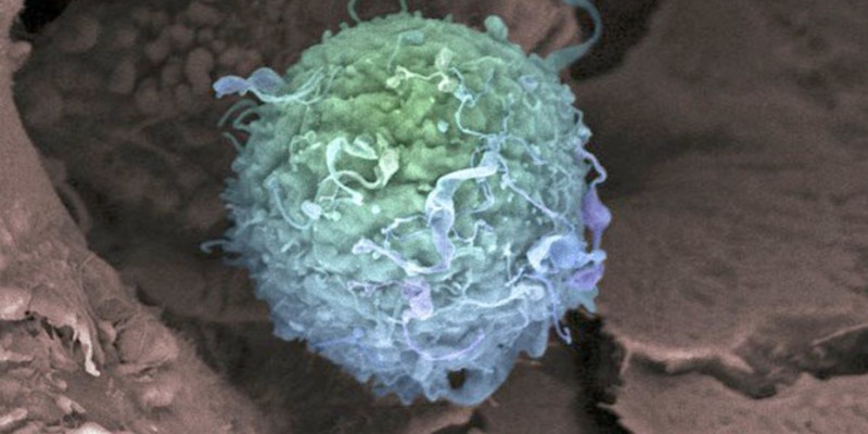 Una nueva “biopsia líquida” permitiría detectar el cáncer antes de que se desarrolle