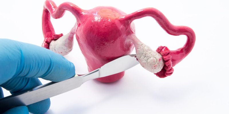Científicos argentinos colaboraron en el descubrimiento de por qué el cáncer de ovario no responde a la inmunoterapia