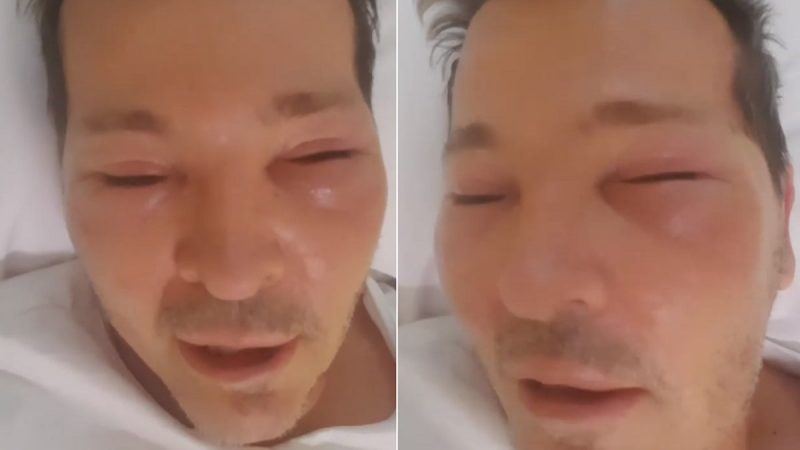 Preocupación por la salud de Guido Süller: está internado con la cara desfigurada