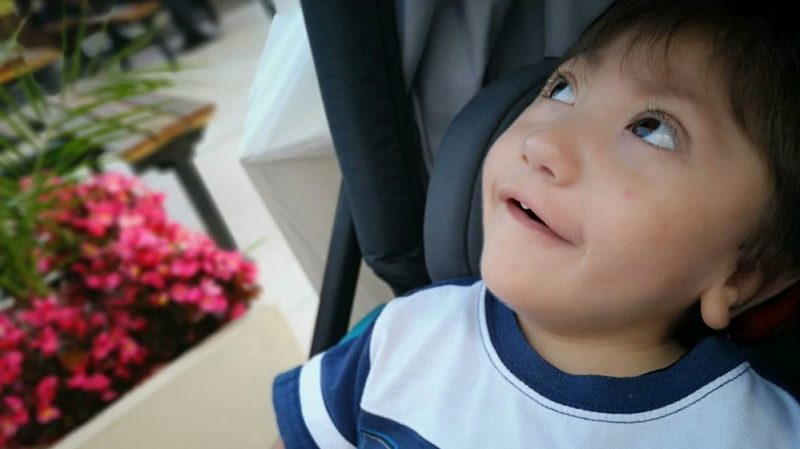Noah, el niño de dos años con microcefalia que generó una campaña solidaria de influencers