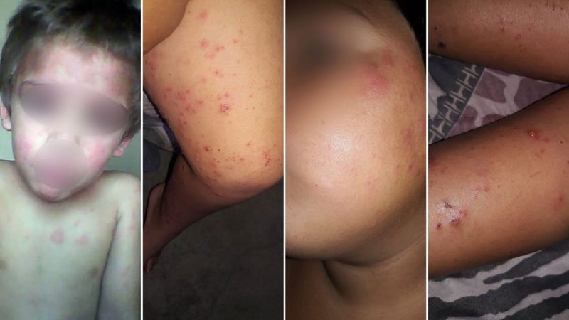 Contaminación del agua y graves problemas de salud: ordenaron suspender la fumigación con agroquímicos en Pergamino