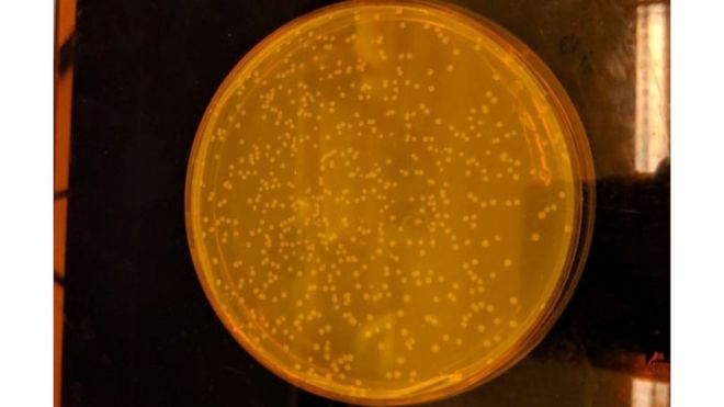 Cómo es el primer organismo vivo del mundo creado por científicos con un código ADN completamente sintético