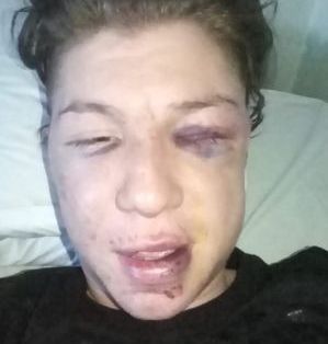 Maipú: un joven denunció que fue brutalmente golpeado por policías y patovicas
