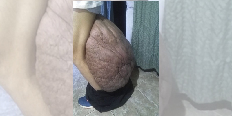 Tiene una rara enfermedad y necesita la ayuda de todos