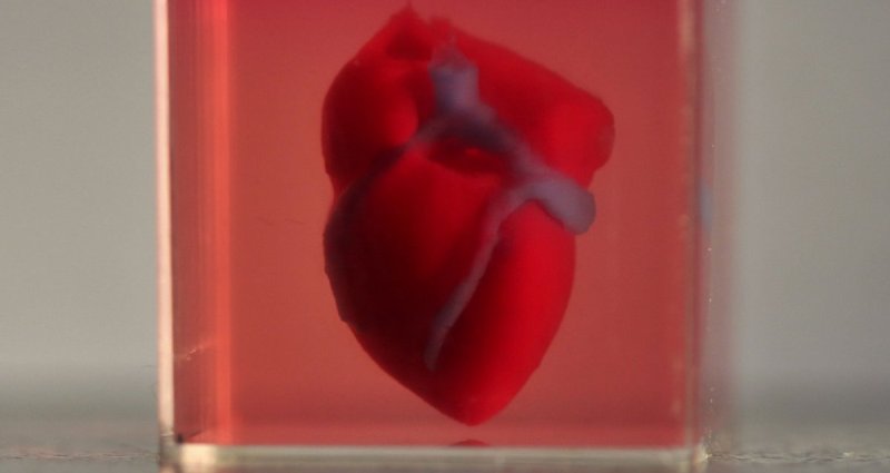 El primer corazón fabricado en impresora 3D y la revolución en el trasplante de órganos que se prepara en Israel