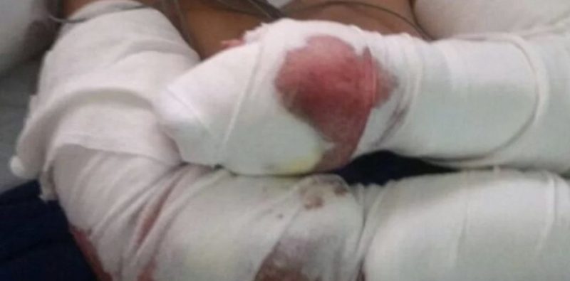 La atacó una jauría en Punta Mogotes y tuvo que meterse al mar para salvarse
