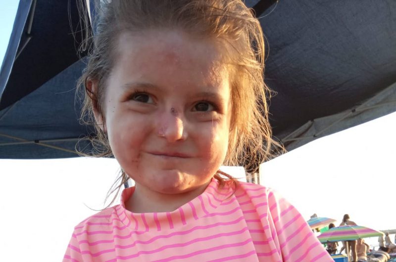 La lucha de una madre para que su hija con piel de mariposa esté protegida en el colegio