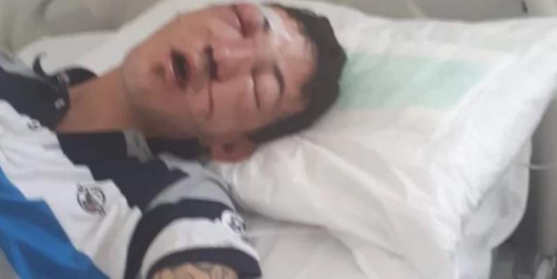 Quiso defender a una chica a la salida de un boliche y dos policías lo molieron a golpes