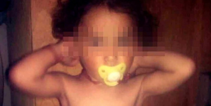 El drama de una nena mendocina que nació con una malformación en sus genitales