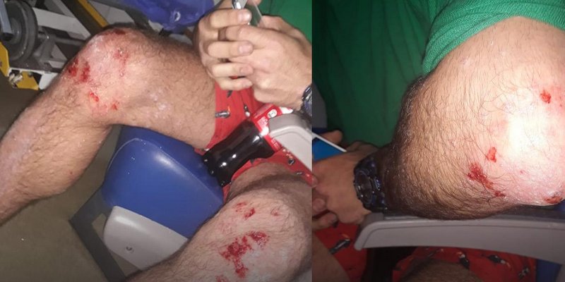 Ataque homofóbico en Villa Urquiza: un hombre persiguió y golpeó con un látigo a una pareja gay