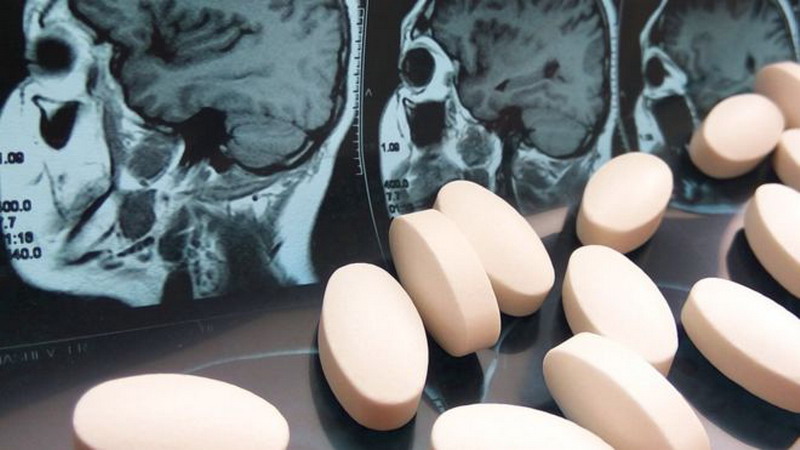 El inesperado efecto del paracetamol y otros medicamentos comunes sobre nuestra personalidad