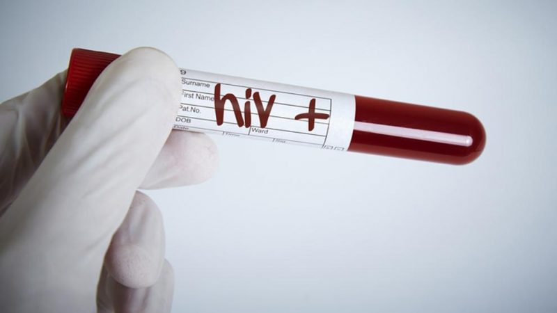 Confirmado el segundo caso en el mundo de curación del VIH