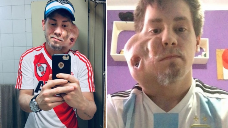 Tiene un tumor, pidió ayuda en las redes y un médico mendocino se comprometió a atenderlo