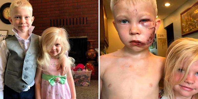 Pequeño gran héroe: un chico de 6 años salvó a su hermana del ataque de un perro