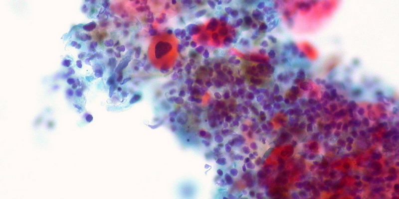Descifran la estructura de una proteína ‘inmortal’ clave para una cura contra el cáncer