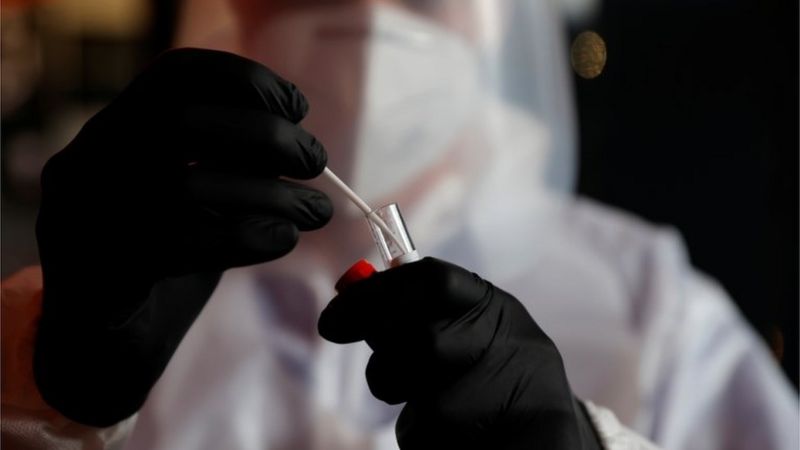 Coronavirus en Argentina: confirmaron 561 muertes en las últimas 24 horas, la cifra más alta desde que comenzó la pandemia