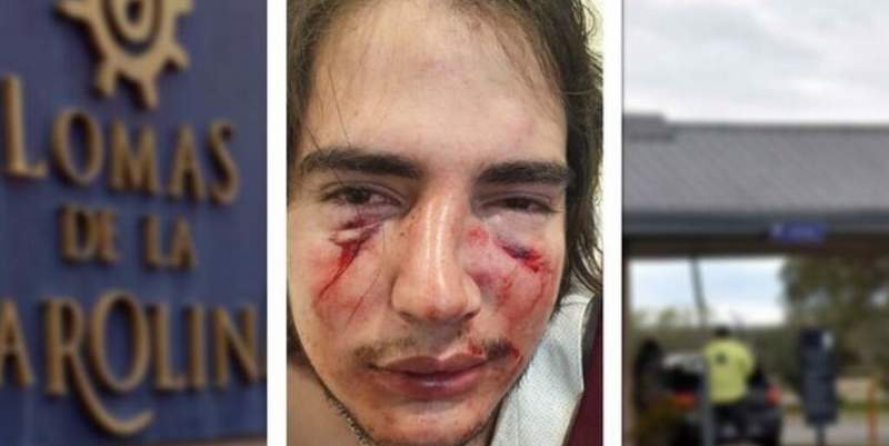 Denuncian una feroz golpiza de rugbiers a un joven de 18 años