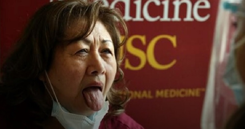 La “lengua covid”, el nuevo síntoma del coronavirus