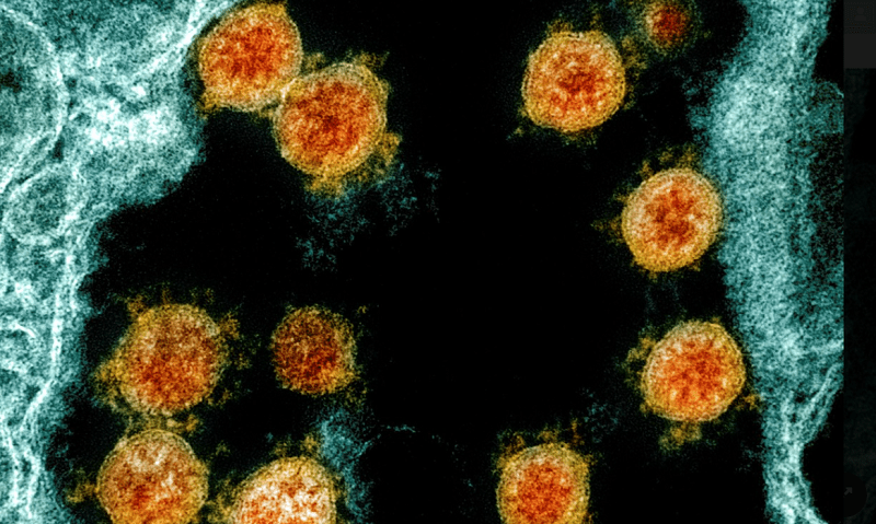 Coronavirus: según expertos, el Covid-19 se transformará en un resfrío en menos de 10 años