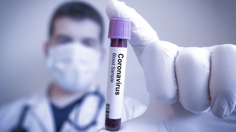 Coronavirus en Argentina: confirmaron 13 muertes y 1.614 contagios en las últimas 24 horas