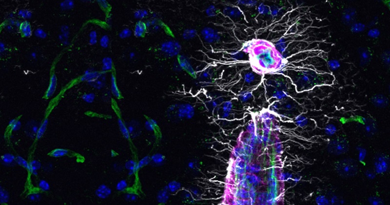 Una molécula que facilita recuperar la memoria estimula la búsqueda de una cura para el alzhéimer