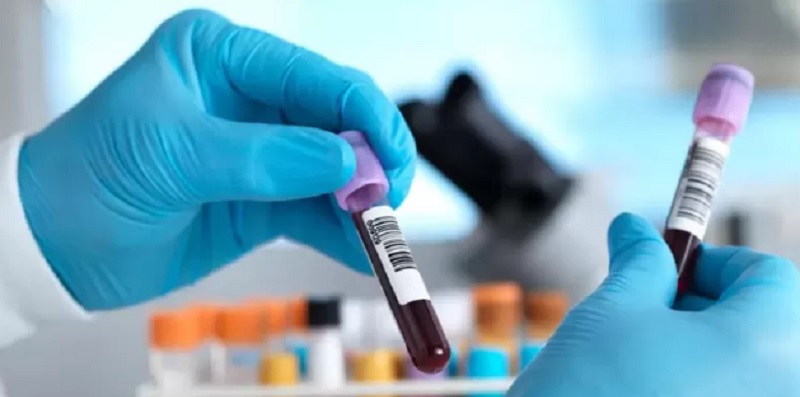 Cómo funciona el nuevo análisis de sangre que detecta 18 tipos de cáncer en etapas tempranas