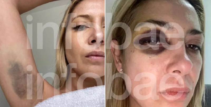La denuncia de Fabiola Yañez contra Alberto Fernández: “Venís golpeándome hace tres días seguidos”
