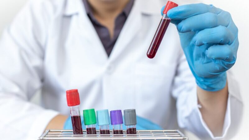 Diagnóstico de anemia: el rol clave del laboratorio y un enfoque multidisciplinario